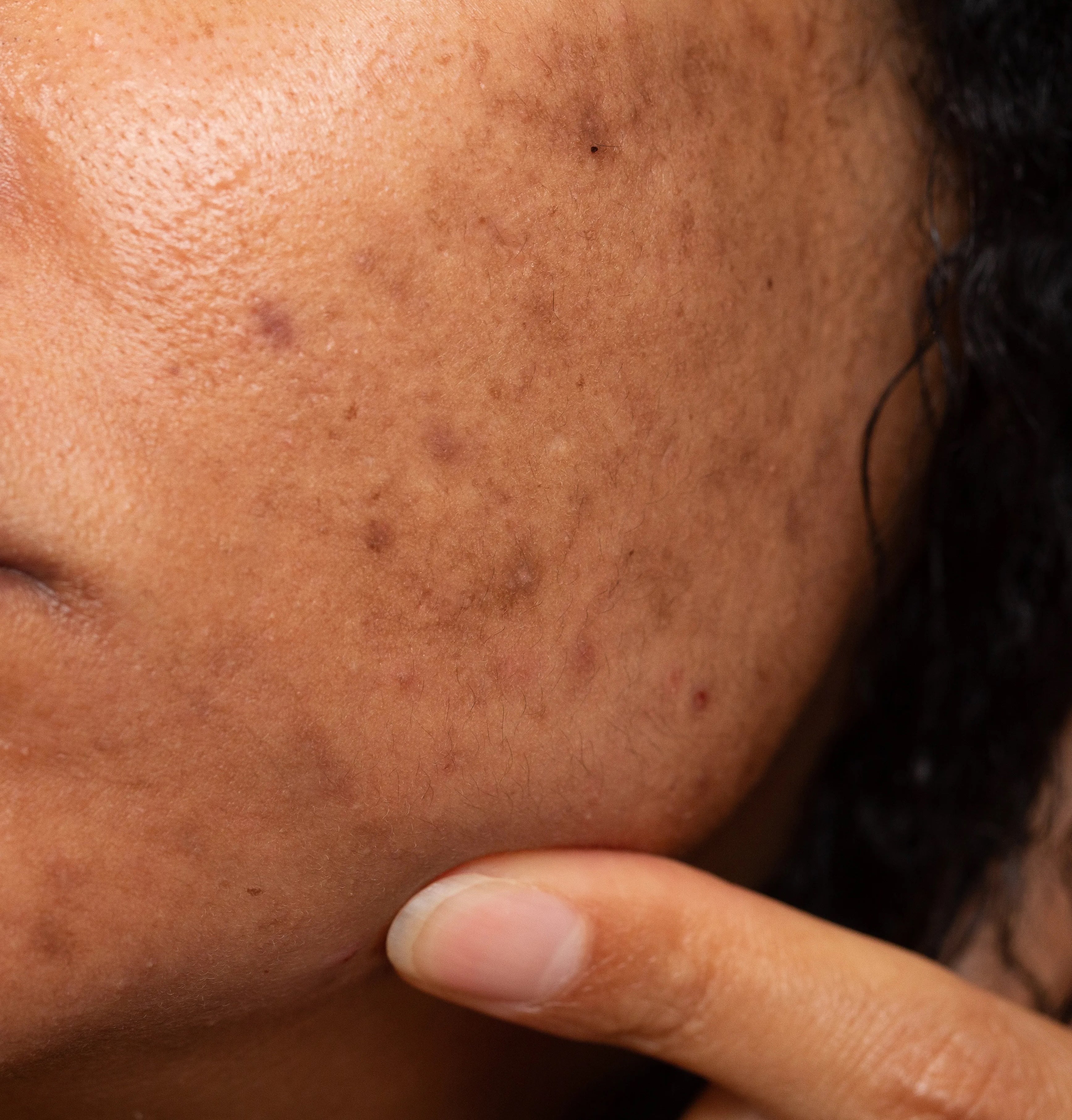 Natural Dark Spot Serum for Black Skin: What Actually Works