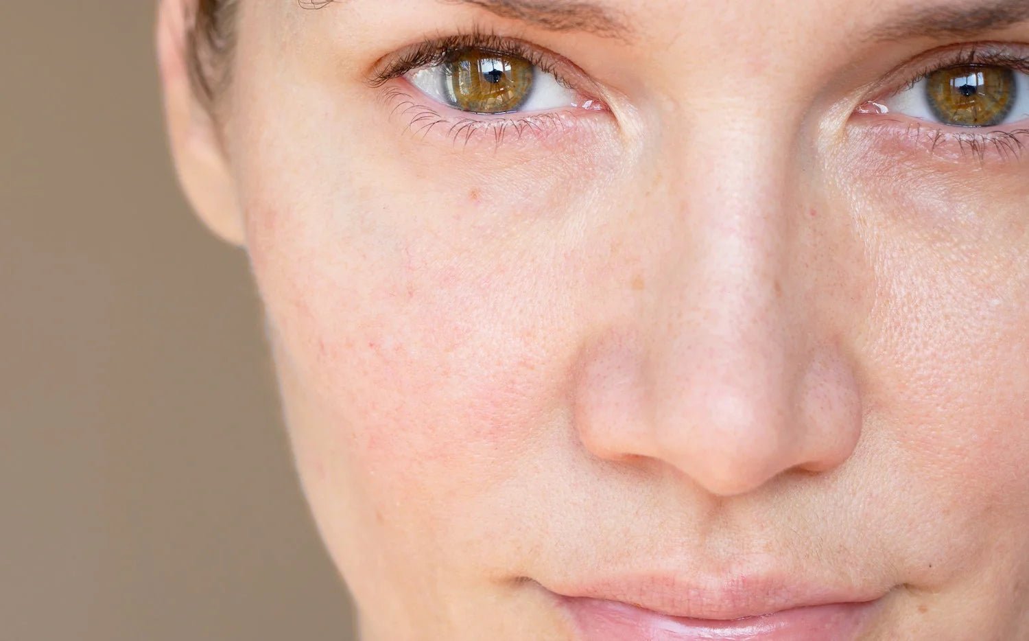 Dull Skin: 6 Steps to Illuminate Your Complexion - SENSEOFREASONS