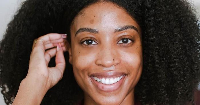 The Best Solutions for Hyperpigmentation - SENSEOFREASONS - SENSEOFREASONS