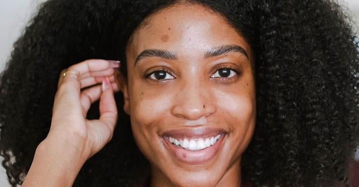 The Best Solutions for Hyperpigmentation - SENSEOFREASONS