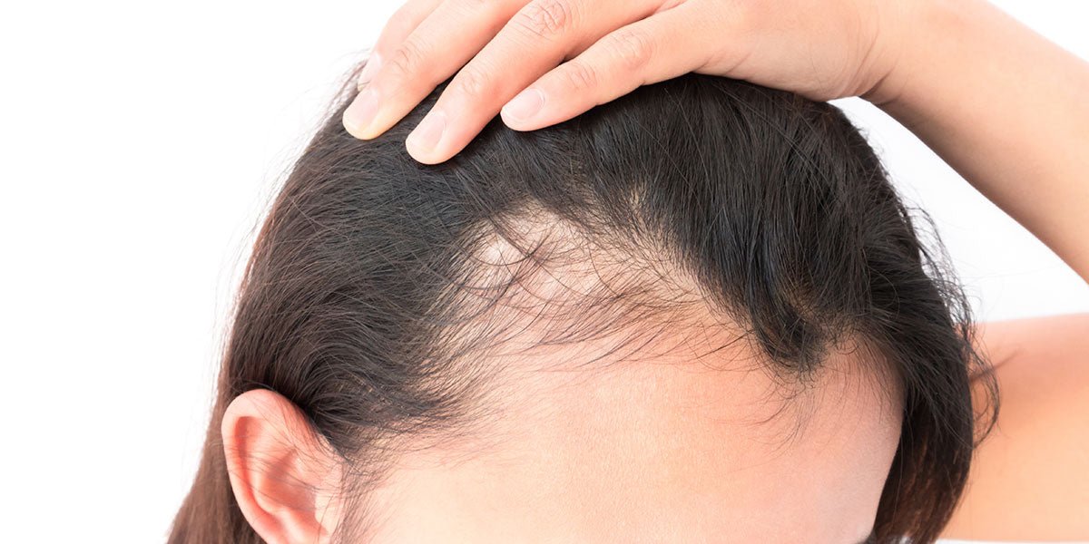 Why is My Hair Falling Out? 10 Causes of Hair Loss - SENSEOFREASONS