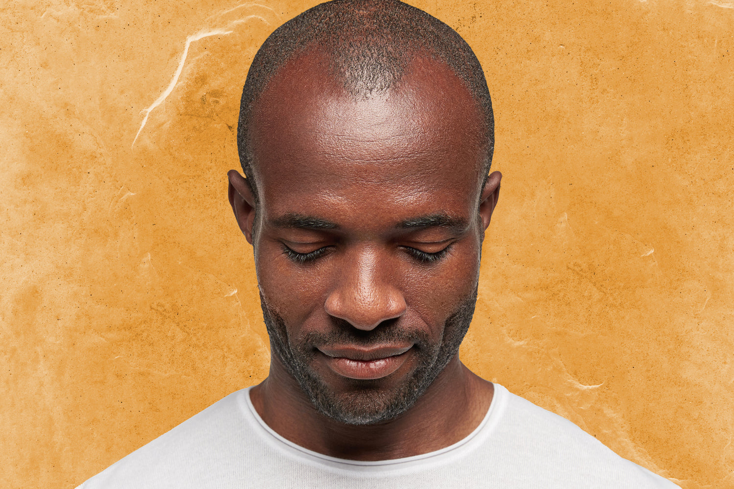 SENSEOFREASONS Banner Alopecia 